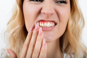 woman suffering from toothache