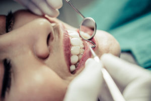 dental implant restoration