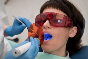 composite teeth bonding