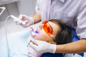 teeth composite bonding