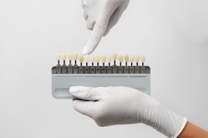 veneers vs crowns