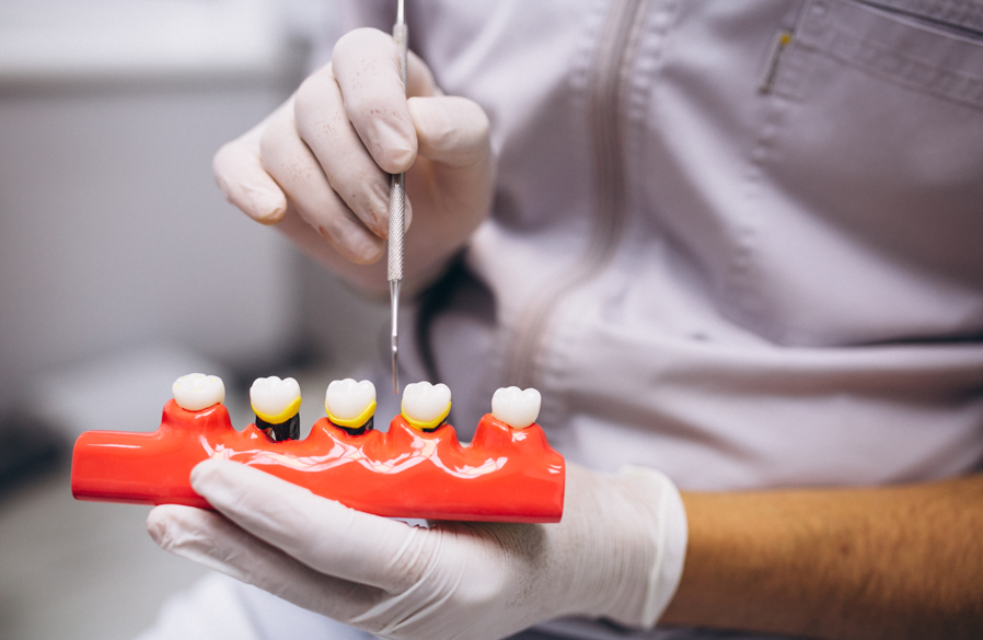 what is a crown for tooth