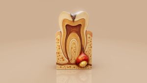 failed root canal symptoms