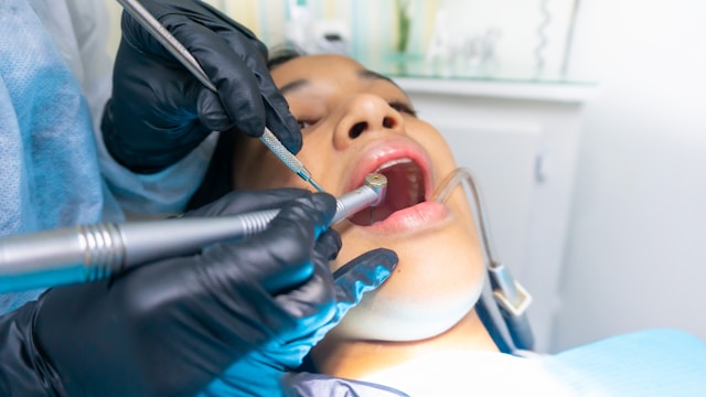 dental filling