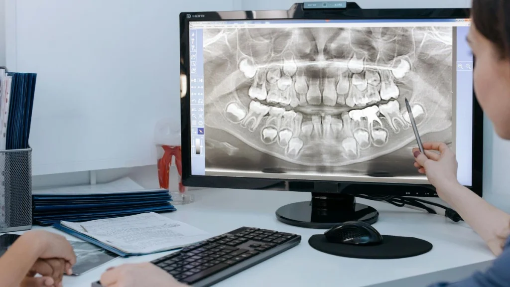 are dental x rays safe