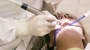 teeth restoration
